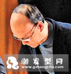 戴假发需要剃光头吗 可以戴假发上班吗