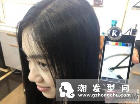 头发很油而且头皮长痘痘怎么办？头皮也需勤保养，洗头时请注意这4步骤！