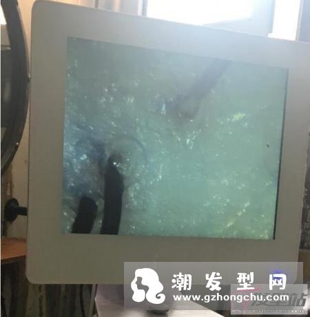 理发店检测头皮是骗局 记者暗访其中猫腻令人傻眼