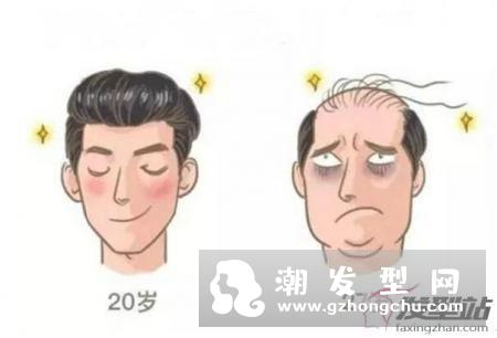鬓角调皮?压鬓角神器大白头莫西干regent mohican轻松搞定男生发型乱