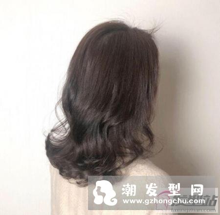 脱发可根据先天体质及后天生活习惯而有不同的分类
