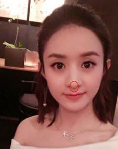 大饼脸瘦下来脸还大吗 瘦下来是什么脸