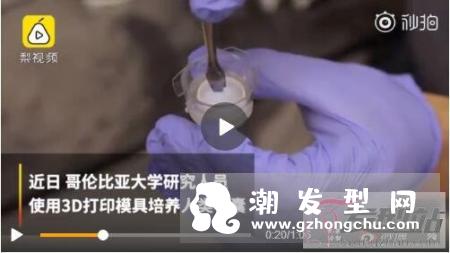 3D打印有望拯救脱发 无限量供应毛囊的速率生长毛囊
