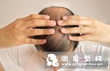 掉发我哭了！为什么会掉发 防掉发秘籍攻略