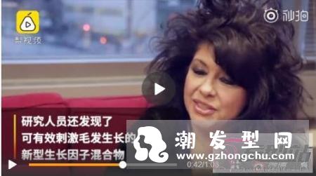 3D打印有望拯救脱发 无限量供应毛囊的速率生长毛囊