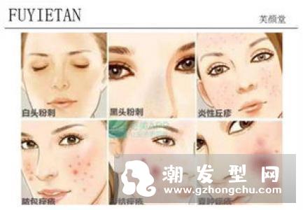 头皮长痘痘成因及解决方法，掉发严重、毛囊炎舒缓有感