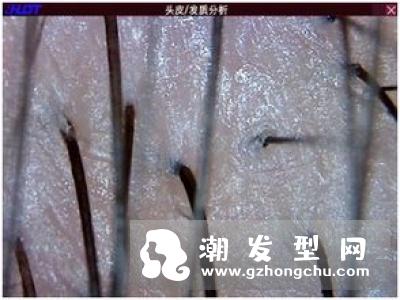 油性头发能焗油吗 头皮痒正常吗