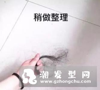 曝宋仲基因婚变脱发 婚变压力大脱发照曝光