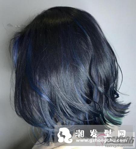脱发可根据先天体质及后天生活习惯而有不同的分类