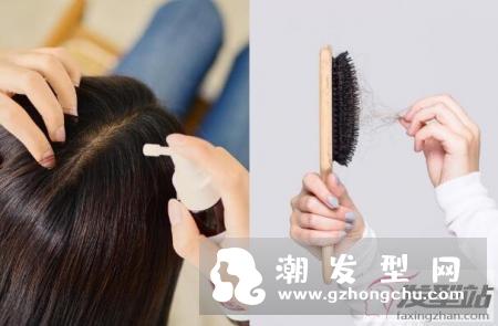 头皮长痘痘成因及解决方法，掉发严重、毛囊炎舒缓有感