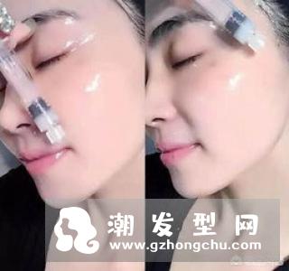 什么人适合漂发 需要头皮隔离吗