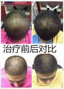 烫头发后掉头发怎么办 药水味怎么去除