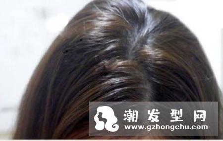 油性头发能焗油吗 头皮痒正常吗