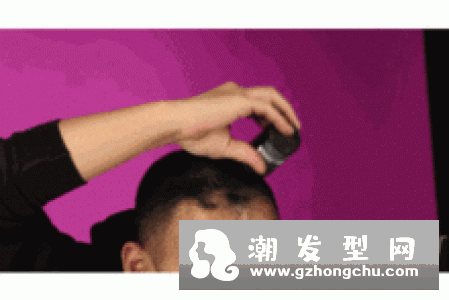 薯条有利于生发，90后脱发有救了？