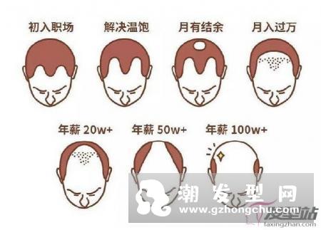 我国脱发人群超2.5亿 如何有效预防和治疗脱发