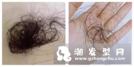 头发分界线也会导致头发稀疏 定期调整头发分界线真的很重要