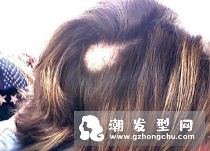 为什么刚洗完头发就出油发臭 这样洗真的变得比较不出油！