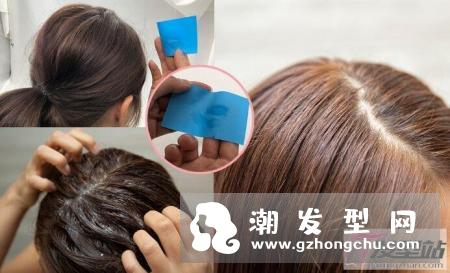 头皮上很多黑头粉刺怎么办 即学头皮清洁2大方法清洁头皮