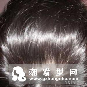 增发食物令发量激增又浓密!–安居客房产问答