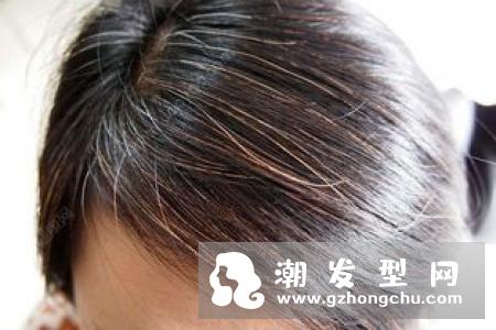 头发油是什么原因怎样调理 3个改善头发出油小妙招
