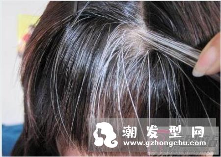产生白头发是什么原因 知己知彼才能有效预防白发