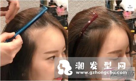 发际线前面脱发怎么办 超强“发际线整形”技巧发量暴增还超自然！