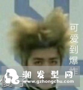 赴韩植发成热潮年轻人的压力还是很大的