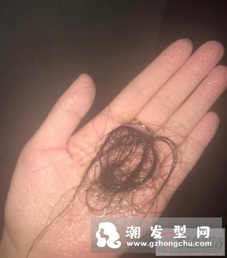 头发健康跟头部血液循环息息相关.ppt