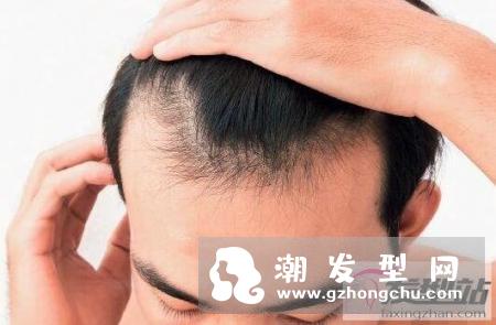 生姜水长期洗头,你怕是要得将头皮洗去一层皮的节奏?