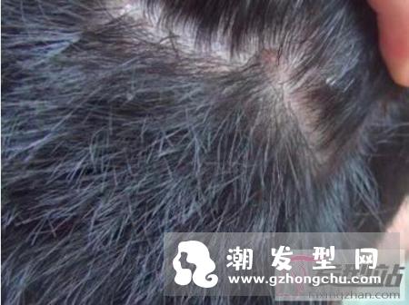 头皮护理保养常识 头皮没顾好脸也会跟着松垮