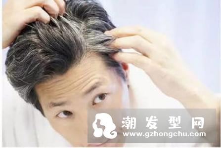 盘点夏季脱发原因 小习惯影响头发健康