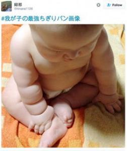 如何判定头皮屑是哪种类型 油性还是敏感别再傻傻分不清