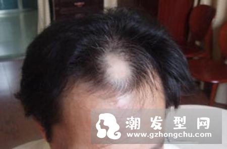 染烫后的头发如何护理 护发小技巧让秀发重焕光泽
