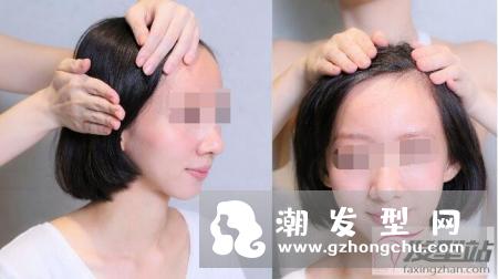 头皮出油还有臭味怎么办 学会居家头皮护理让你远离臭头尴尬