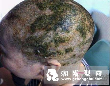 染发前要注意什么哪些人不适合染发？女子染发操作失败后被剃光头住院！