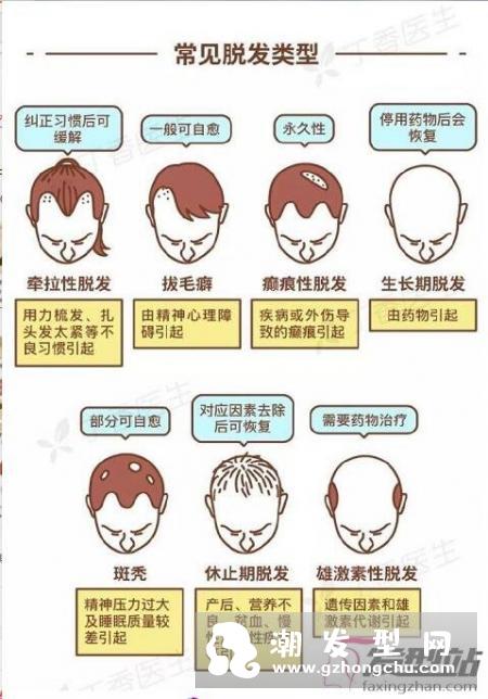 我国脱发人群超2.5亿 如何有效预防和治疗脱发