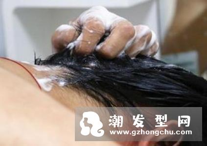 少女脱发严重原因及治疗方法 中西医教你从生活习惯减少脱发
