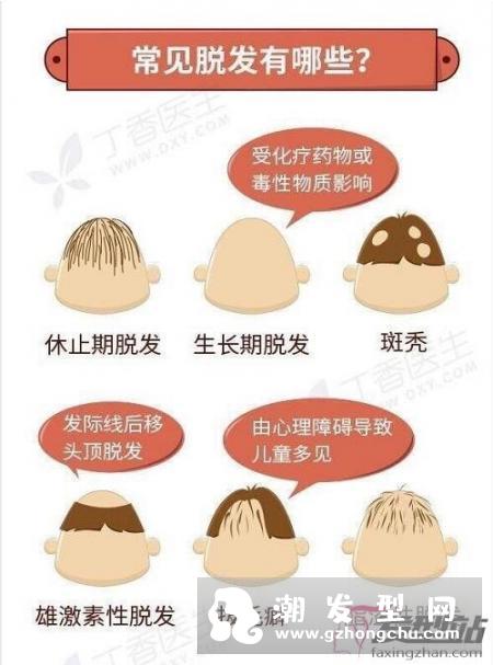 我国脱发人群超2.5亿 如何有效预防和治疗脱发