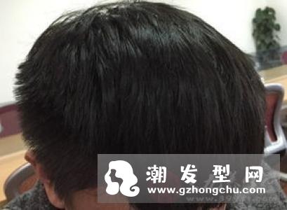 头发健康跟头部血液循环息息相关.ppt