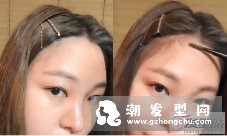 发际线前面脱发怎么办 超强“发际线整形”技巧发量暴增还超自然！