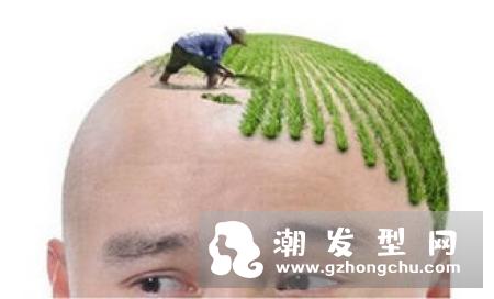 种植头发的原理 一般多少钱