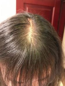 空气刘海扁塌怎么办 怎么控油