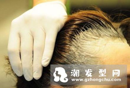 染发为什么要加热 染到皮肤怎么清洗