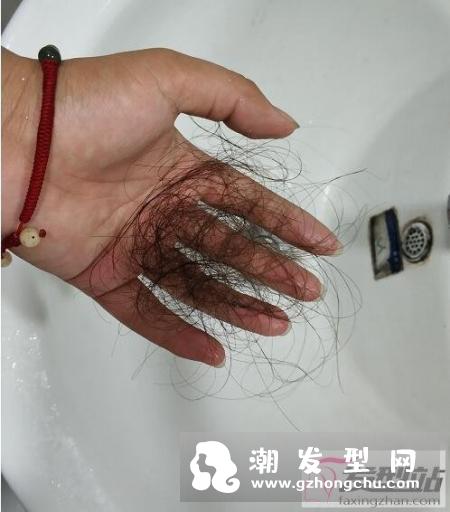 头发健康跟头部血液循环息息相关.ppt