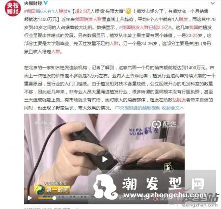 我国脱发人群超2.5亿 如何有效预防和治疗脱发
