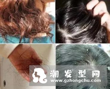 头发烫染之后跟枯草一样怎么办 脱发可以烫吗