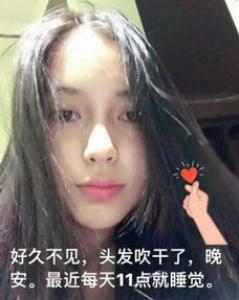 如何防止发际线后移 这个元凶很多人都不知道
