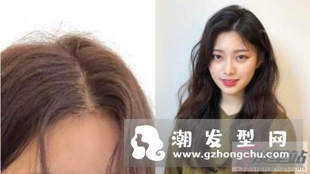 短刘海分线秃会出现在头顶、长刘海则是在分线处,眼看着越来越秃的分线,有办法可
