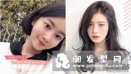 发际线前面脱发怎么办 超强“发际线整形”技巧发量暴增还超自然！