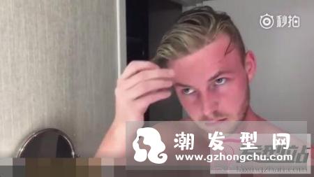 地中海发型怎么弄好看 男人秃顶适合什么发型